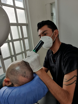 Slider image (7) SMP Advanced - Scalp Micro Pigmentation